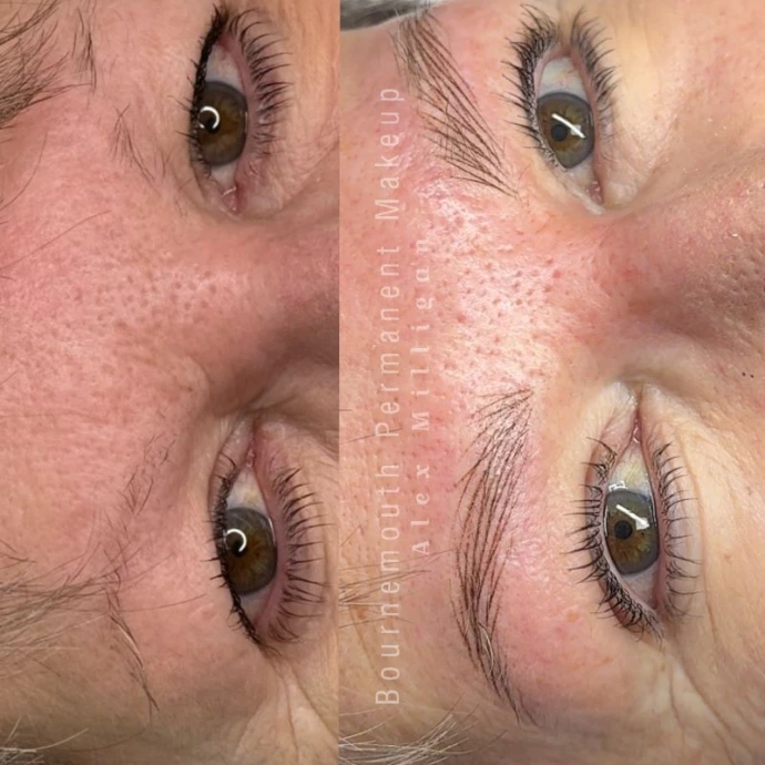 Realistic Results Designed to Enhance Shape, Improve Symmetry and Restore Fullness